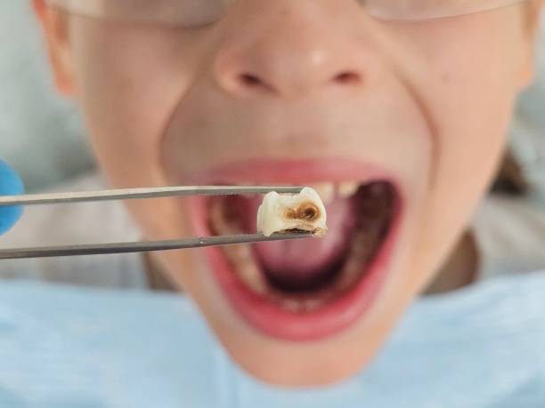 Best Weekend Emergency Dentist in Annetta, TX